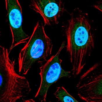 JAK2 Antibody