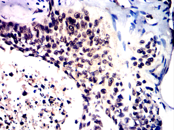 JAK2 Antibody