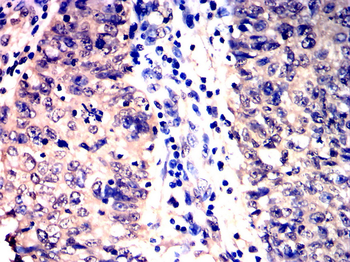 JAK2 Antibody