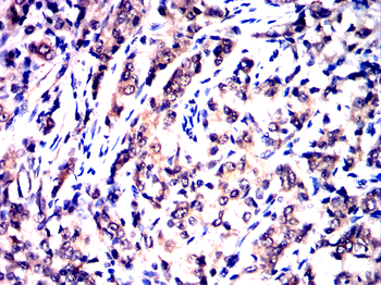 JAK2 Antibody