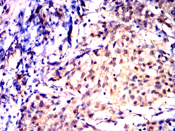 JAK2 Antibody