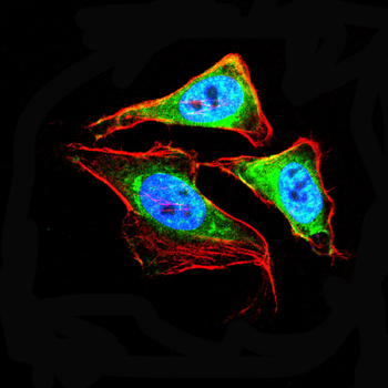 CCL2 Antibody