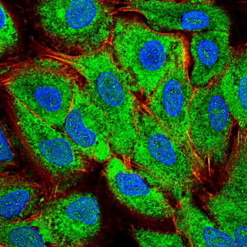 COL4A1 Antibody