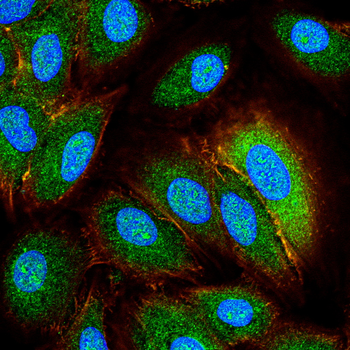 ZEB1 Antibody