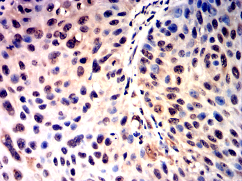 ZEB1 Antibody