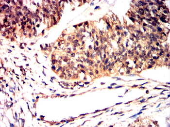 ZEB1 Antibody