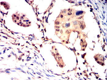 ZEB1 Antibody