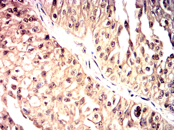 SNAI2 Antibody