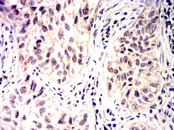 SNAI2 Antibody