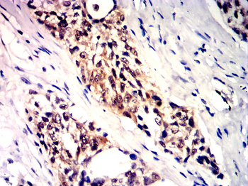 IRS1 Antibody