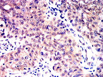 IRS1 Antibody