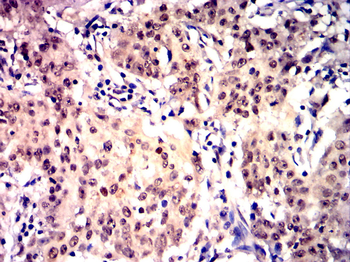 IRS1 Antibody