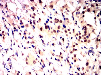 IRS1 Antibody