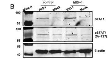 STAT1 Antibody