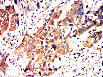 COL2A1 Antibody