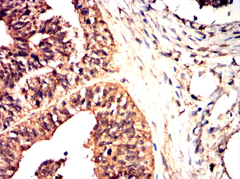 COL2A1 Antibody