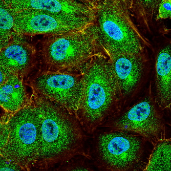 JAK1 Antibody