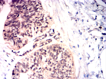 JAK1 Antibody