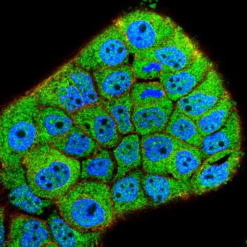 MMP2 Antibody