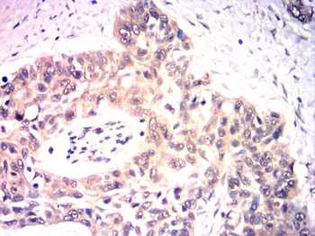 MMP2 Antibody