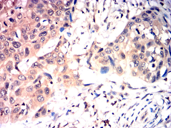 MMP2 Antibody