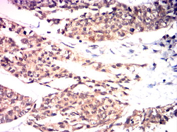 MMP2 Antibody