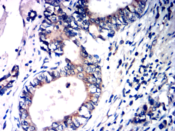 MMP2 Antibody