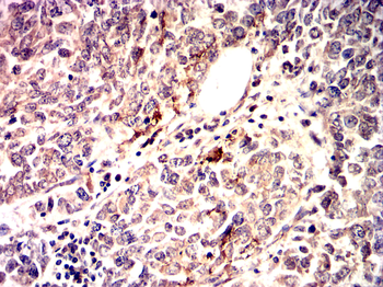DNM1L Antibody