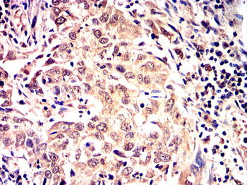 DNM1L Antibody