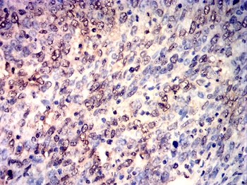 TWIST1 Antibody