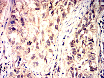 TWIST1 Antibody