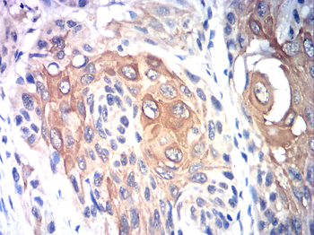 PIK3CA Antibody