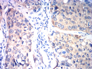PIK3CA Antibody
