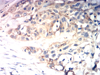 PIK3CA Antibody