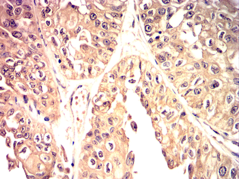 SREBF1 Antibody
