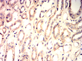 SREBF1 Antibody