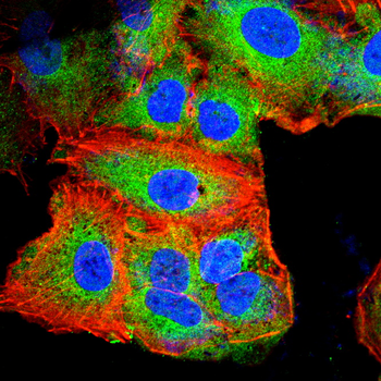RPS6KB1 Antibody