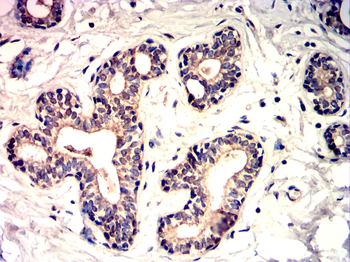 RPS6KB1 Antibody