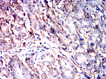 RPS6KB1 Antibody