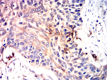RPS6KB1 Antibody