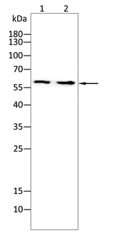 RPS6KB1 Antibody