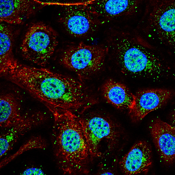SMAD2 Antibody
