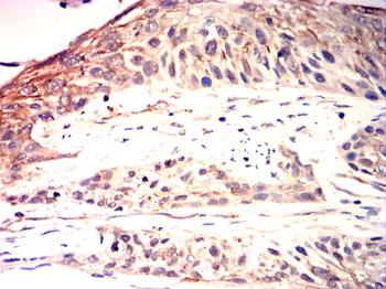 SMAD2 Antibody