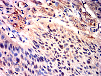 SMAD2 Antibody