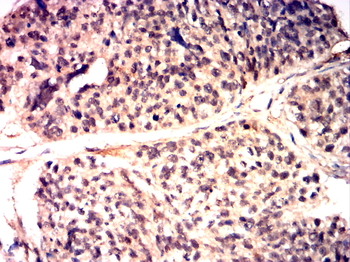 SMAD2 Antibody
