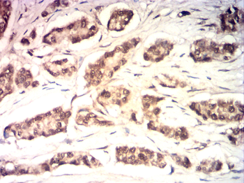 ESR2 Antibody