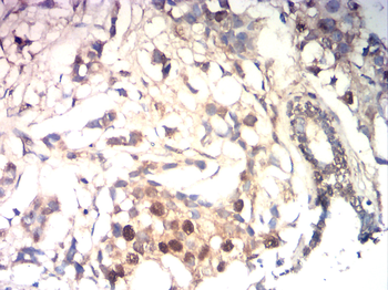 ESR2 Antibody