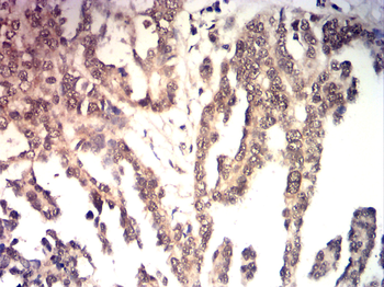 ESR2 Antibody