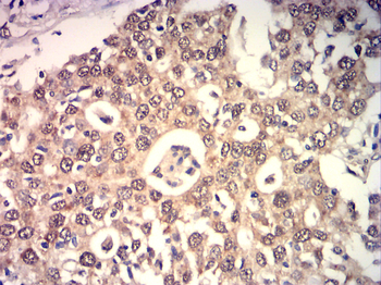 ESR2 Antibody