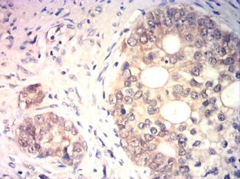ESR2 Antibody